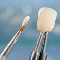 Zahnarzt Zinn Gießen Ästhetische Zahnheilkunde